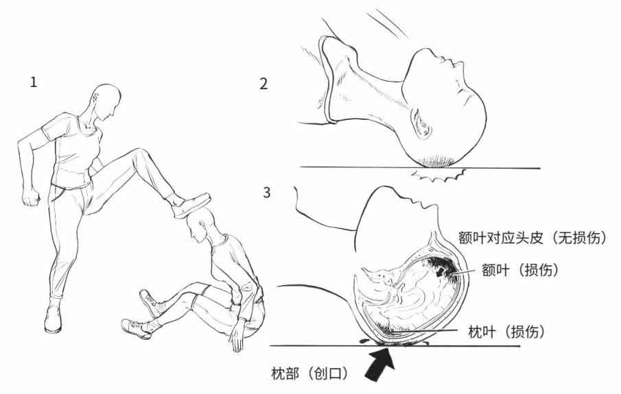 超正经凶案调查