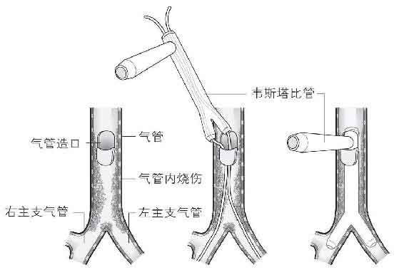 打开一颗心