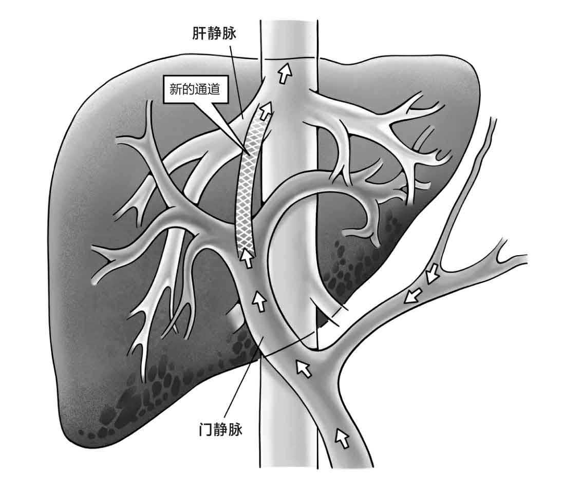 命悬一线我不放手