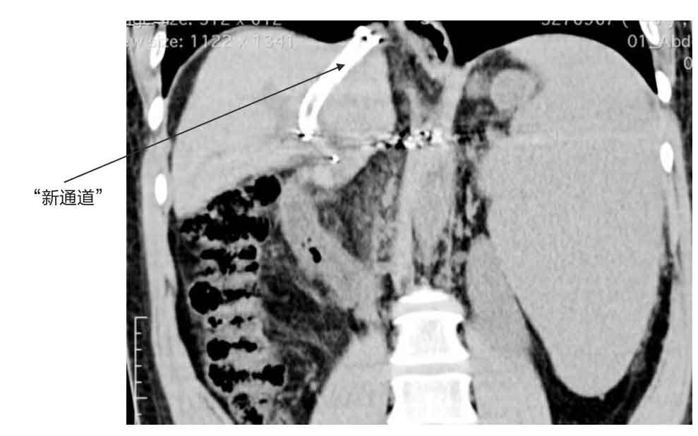 命悬一线我不放手